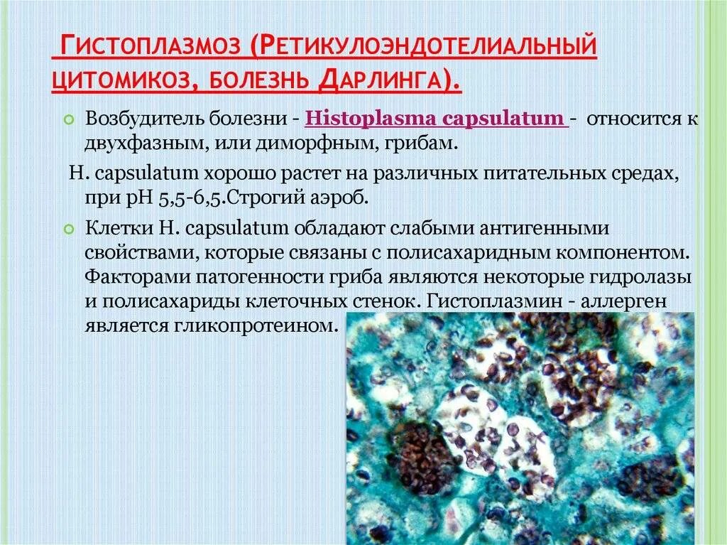 Микроплазменная инфекция симптомы