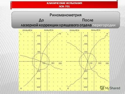 Риноманометрия