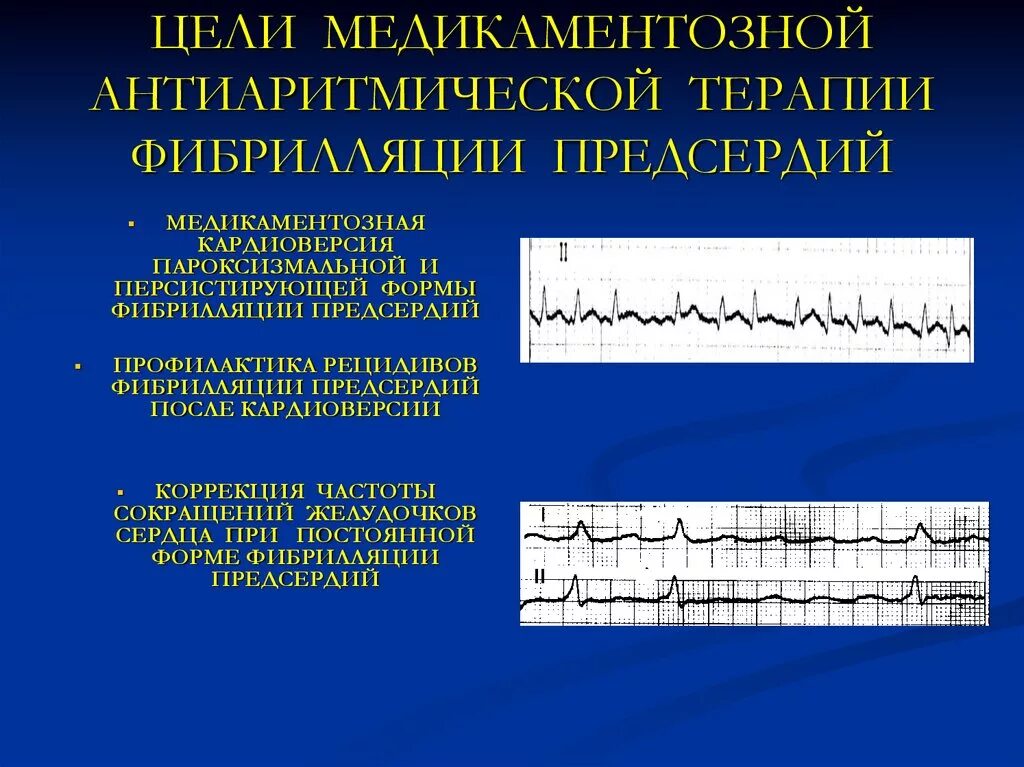 Пароксизмальная форма фибрилляции предсердий ЭКГ. ЭКГ при фибрилляции предсердий тахисистолическая форма. Формы фибрилляции предсердий ЭКГ. Фибрилляция предсердий нормоформа. Формы трепетания предсердий