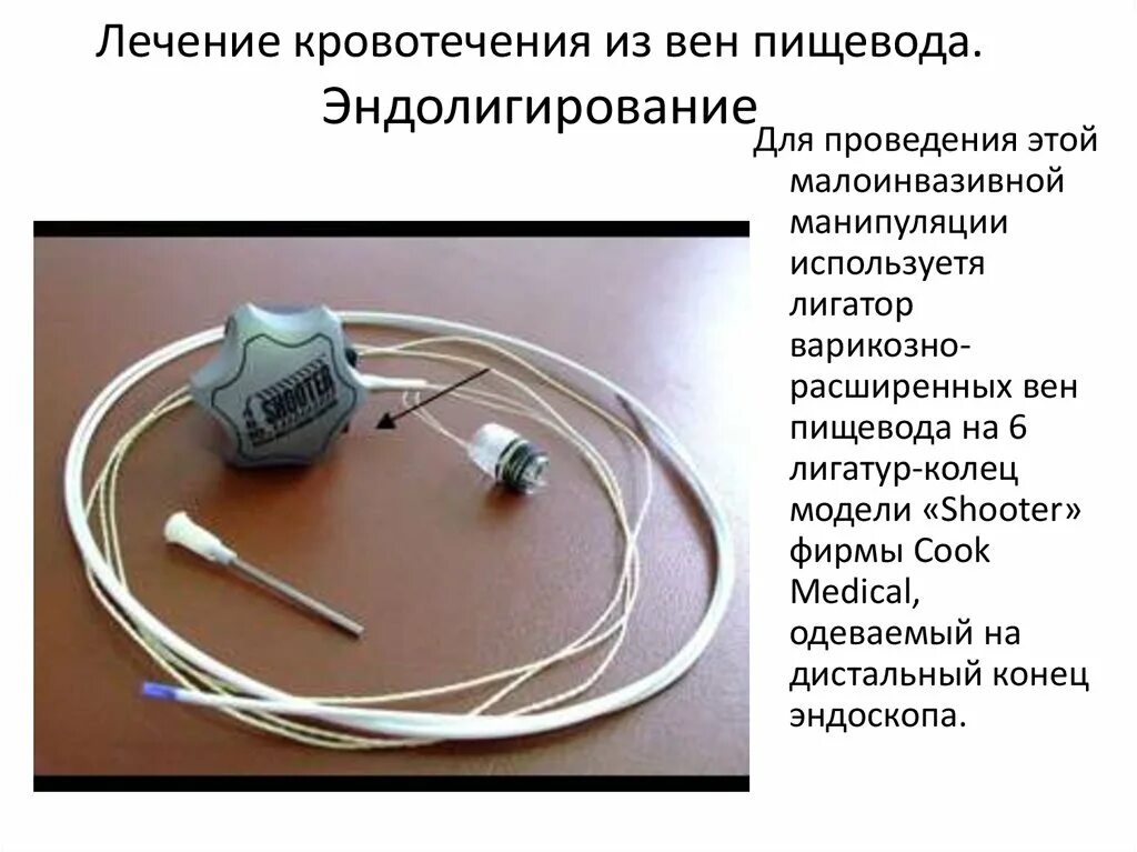 Лечение вен пищевода. ВРВП -варикозное расширение вен пищевода. Лигатор для лигирования варикозно-расширенных вен пищевода. Кровотечение из варикозно расширенных вен пищевода. Кровотечение из варикозно расширенных вен пищевода лечение.