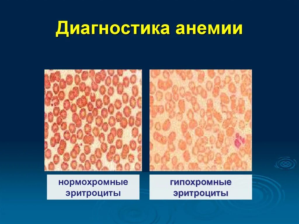 Тесты анемия у детей. Диагностика анемии. Лабораторная диагностика анемий. Методы исследования при анемии. Инструментальные исследования при анемии.