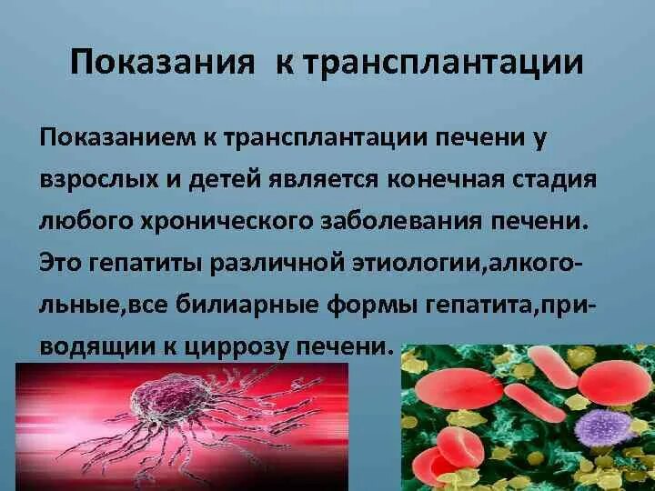 Гепатиты и трансплантация. Вирусный гепатит b. Гепатиты и трансплантация. Цирроз печени показания для трансплантации. Гепатиты и трансплантация.
