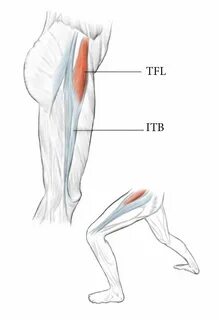 Hipped leg