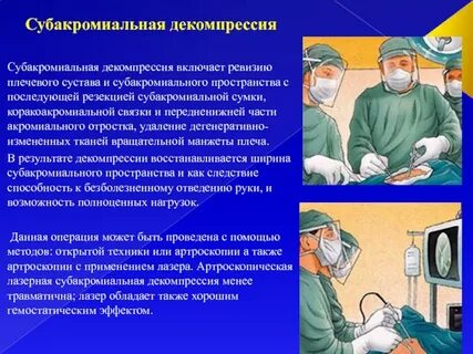 Декомпрессия это