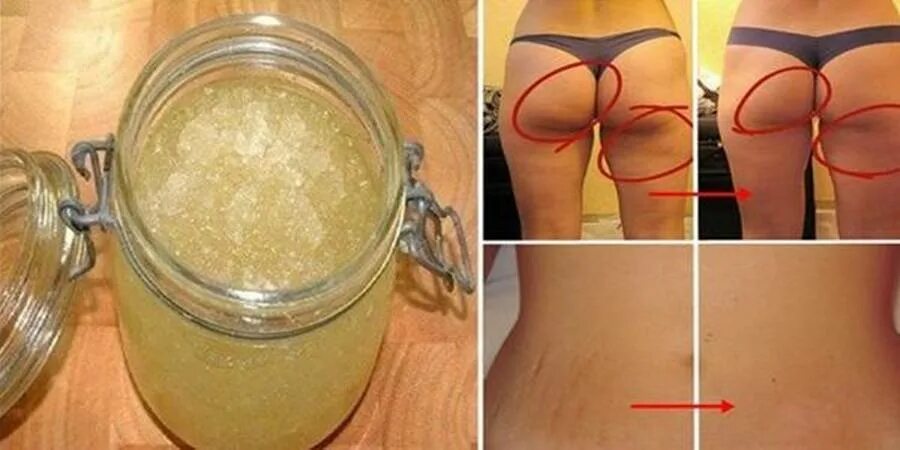 Обертывание при месячных можно ли