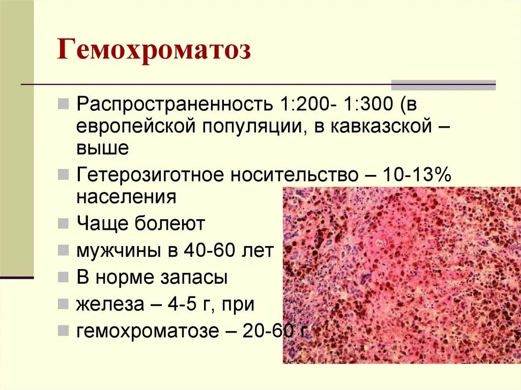 Без гемохроматозов