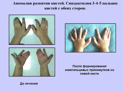 Дефекты кисти