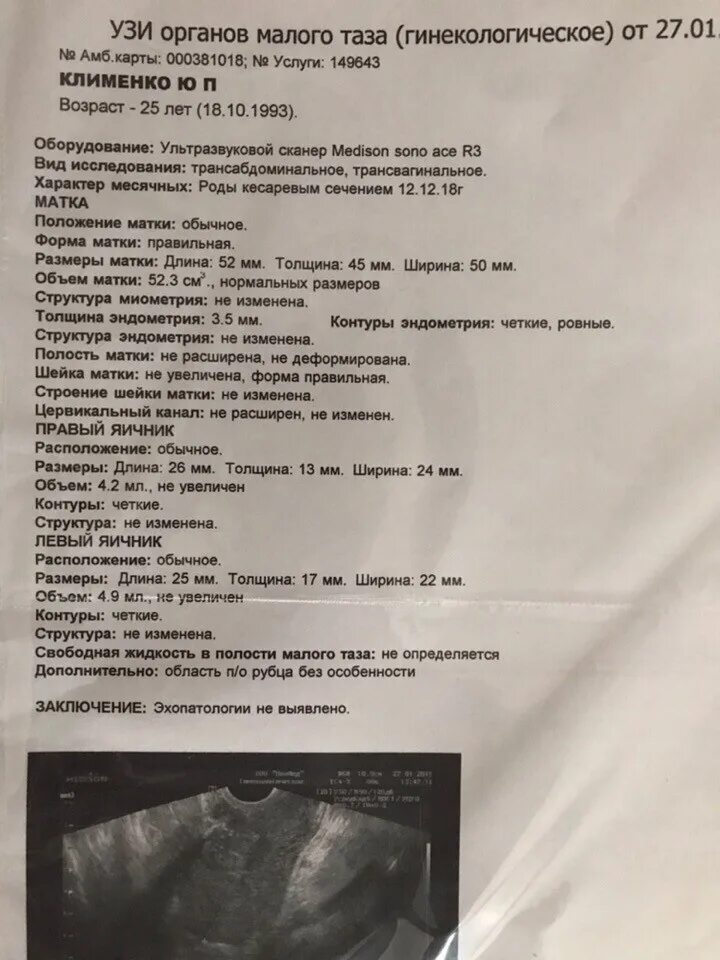 При месячных можно делать узи малого таза. Протокол ультразвукового исследования малого таза. УЗИ малого таза заключение в норме. УЗИ органов малого таза заключение норма. УЗИ органов малого таза протокол.