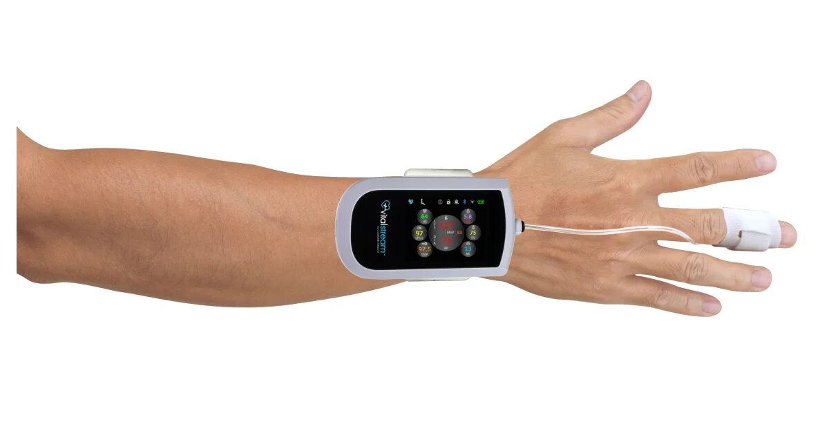 Wireless monitoring. Wireless monitoring