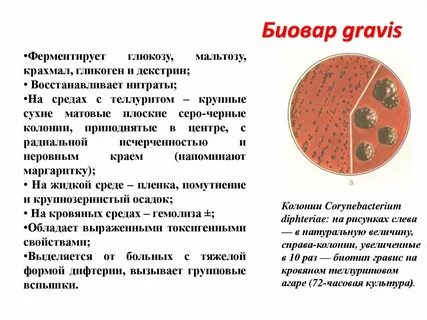 Гравис