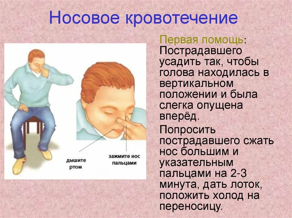 Причины носового кровотечения. Нососовое кровотечение. При носовом кровотечении.