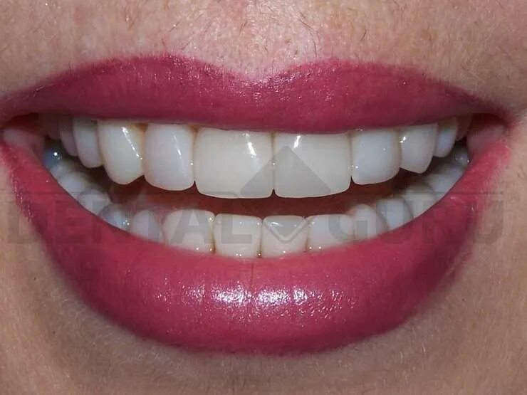 Example smile