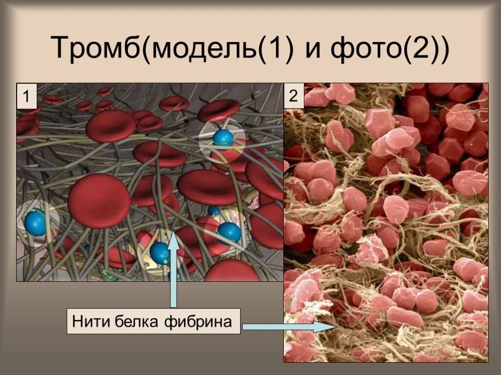 Фибрин функция белка. Образование фибрина в крови.