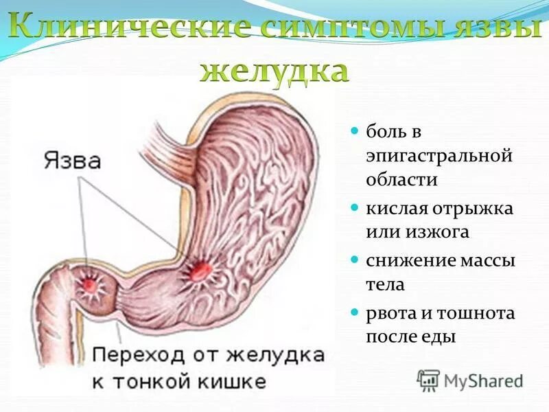 Поем боли в желудке