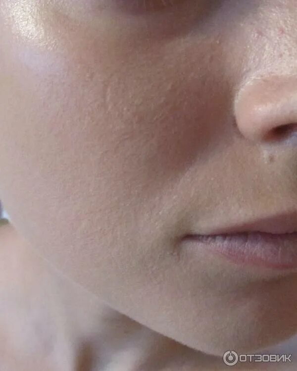 сухая кожа после тонального крема. обезвоженная кожа лица фото. здоровый цвет лица. лицо девушки в профиль нанесение крема. тональник для сухой кожи.