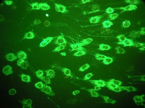 Микобактерии туберкулеза люминесцентная микроскопия. Хламидии люминесцентная микроскопия. Люминесцентная микроскопия микробиология. Метод люминесцентной микроскопии. Фитопланктон вес