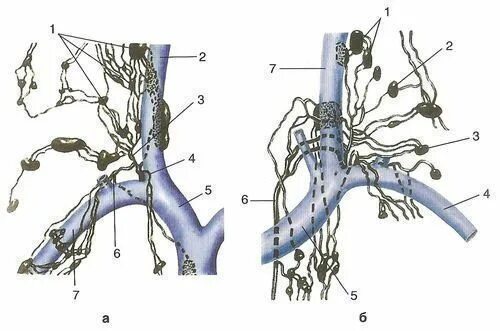 Лимфатическая система правый венозный угол. Регионарные шейные лимфоузлы. Венозный угол и лимфатические протоки. Регионарные лимфоузлы головы. Лимфоузлы кисти