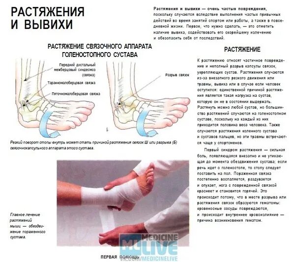 Повреждение капсульного аппарата голеностопного сустава. Капсульно-связочный аппарат стопы. Растяжения связок голеностопного сустава мазь от растяжения связок. Капсульно-связочный аппарат голеностопного сустава. Разрыв связки и перелом голеностопного сустава.