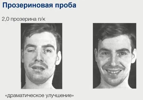 Прозеринова проба