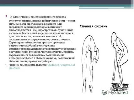 Сухотка