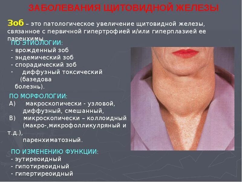 Внешние признаки заболевания. Заболевание щетовиднойжелезы. болезнищиьтовиднойжелезы. заболевания щитовидной железы. нарушение щитовидной жел.