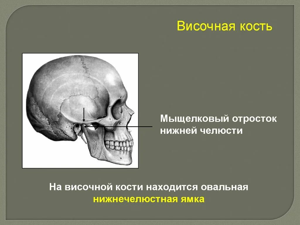 Мыщелковый отросток нижней челюсти. Отростки височной кости. Височная ямка. Мыщелковый отросток височной кости.