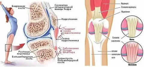 Почему отекает мышца