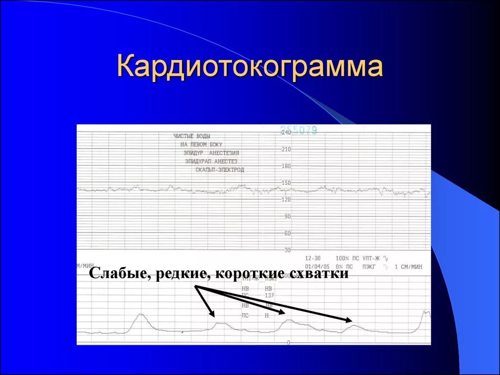 Схватки видел