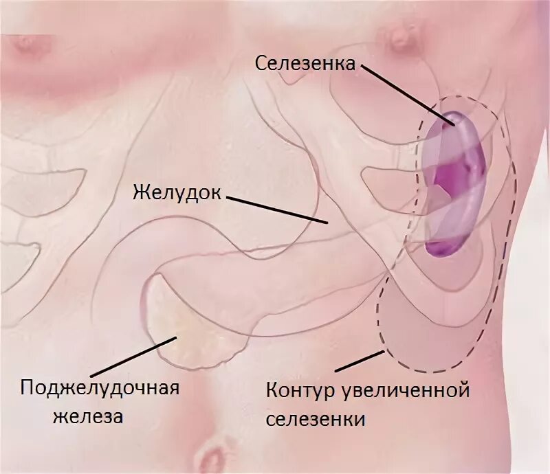 Селезёнка где. Расположение селезенки. Расположение селезенки у человека. Как болит селезенка в левом боку