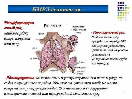 Рак какая ткань
