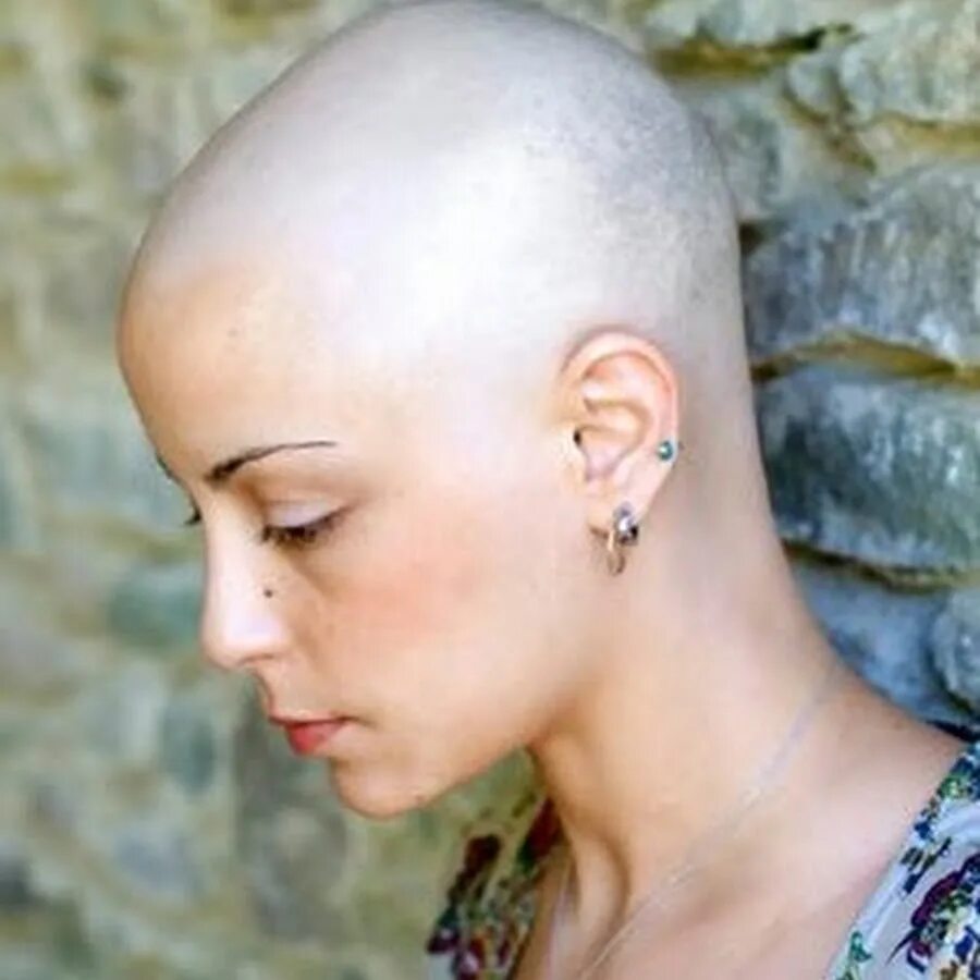 Волосы после химиотерапии. Восстановление волос после химиотерапии. Рост волос после химиотерапии. Женские стрижки при химиотерапии.