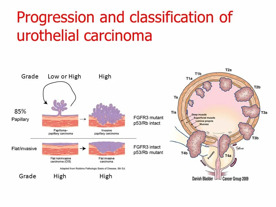 Low grade яичников. Lung Cancer classification.