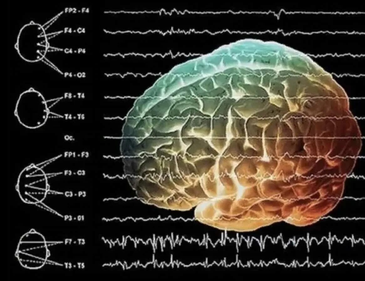 Ритмы мозга Альфа бета тета Дельта ритмы. Альфа бета гамма тета волны частоты мозга. Электрическая активность головного мозга. Волны мозговой активности.