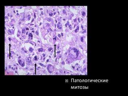 Нарушение фаз митоза патологические изменения