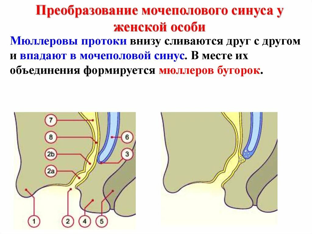 Урогенитальный синус. Персистирующий урогенитальный синус. Урогенитальный синус. Пороки развития прямой кишки эмбриогенез. Урогенитальный синус.