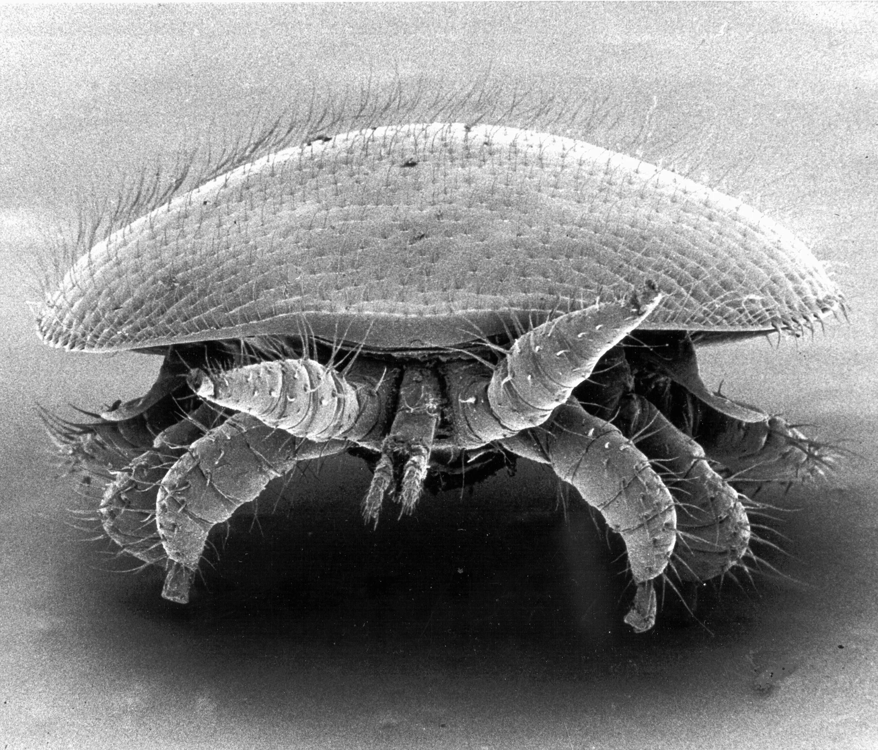 Тропилелапсоз пчел. Клещ варроа под микроскопом. Варроатоз пчел под микроскопом.