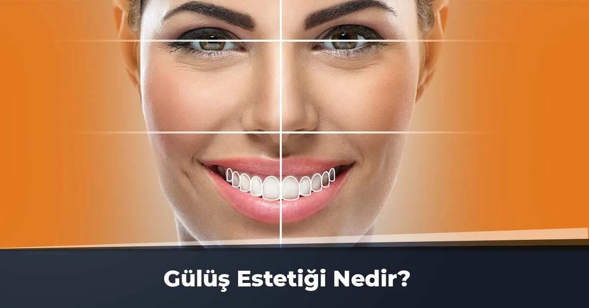 Smile design