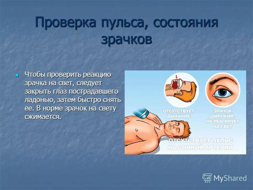 Зрачки и пульс проверить. Реакция зрачков на свет у пострадавшего. Отсутствие пульса на сонной артерии. Прямая реакция зрачка. Выявление реакции зрачка на свет.