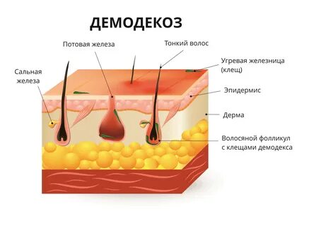 Демодекоз эффективное лечение
