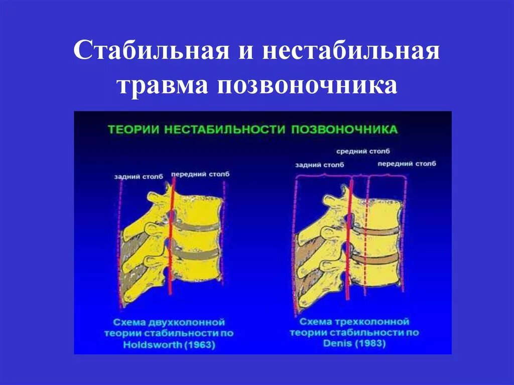 Спинальная нестабильность что это. Классификация нестабильных переломов позвоночника. Клиновидный компрессионный перелом позвоночника. Нестабильный компрессионный перелом позвонка. Стабильные и нестабильные компрессионные переломы позвоночника.