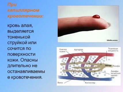 Кровотечение при кашле алой кровью