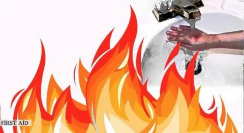 Ожог рисунок