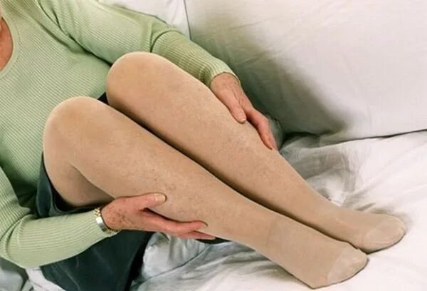 Панная кожа конечностей. Ноги с отеками в компрессионных чулках. Банная кожа конечностей что это. Банная кожа конечностей что это. Yjub vekmnziyst.