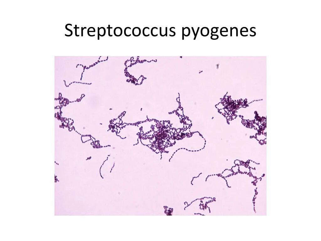 Пиогенный стрептококк возбудитель. Стрептококк пиогенес (Streptococcus pyogenes. Стрептококк микроскопия. Стрептококк группы а возбудитель. Тест стрептококк группы а
