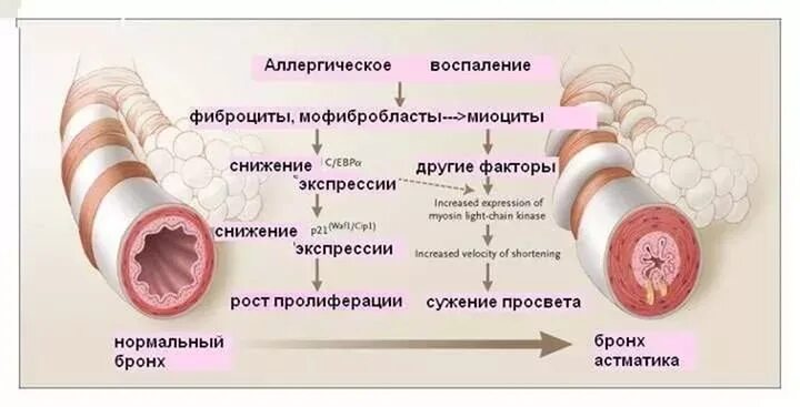 Как быстро снять приступ аллергии Фото АЛЛЕРГИЧЕСКИЕ РЕАКЦИИ НА РАСТЕНИЯ