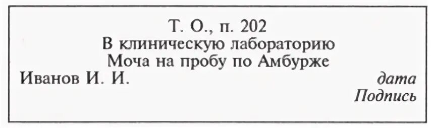 Анализ мочи по амбурже