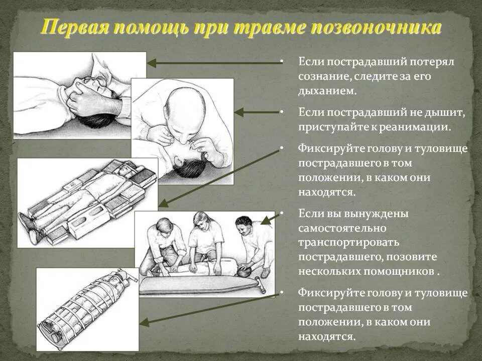 Изолированное положение. Алгоритм оказания помощи при травме позвоночника. ПМП при травме позвоночника. Перелом позвоночника ПМП. Первая медицинская помощь при переломе позвоночника.