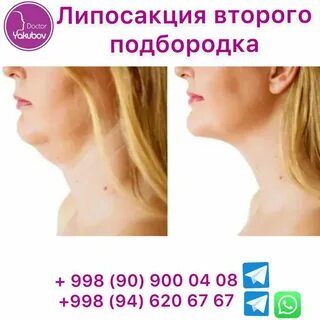 Убрать подбородок отзывы