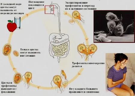 Лямблия стадии