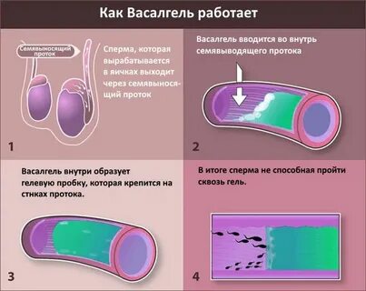 Новое средство для мужской контрацепции: забудь о презервативах